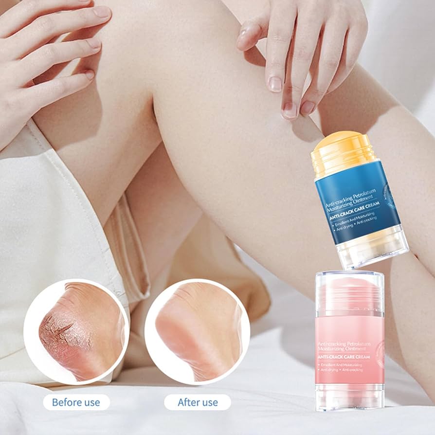 HiH Crack Cream for Feets and hands