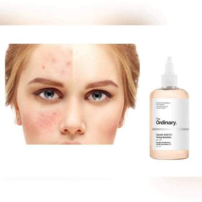 The Ordinary Glycolic Acid 7% Exfoliating Toner